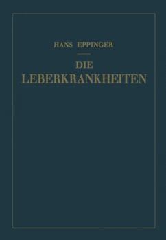 Paperback Die Leberkrankheiten: Allgemeine Und Spezielle Pathologie Und Therapie Der Leber [German] Book