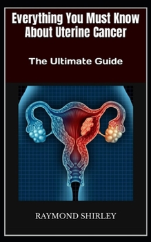 Paperback Everything You Must Know About Uterine Cancer: The Ultimate Guide Book