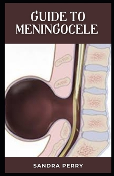 Guide to Meningocele: Meningocele is a type of spina bifida.