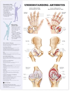 Hardcover Understanding Arthritis Anatomical Chart Book