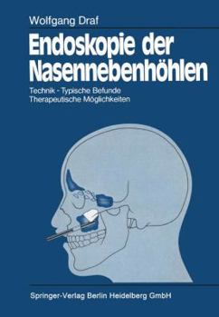 Paperback Endoskopie Der Nasennebenhöhlen: Technik - Typische Befunde, Therapeutische Möglichkeiten [German] Book