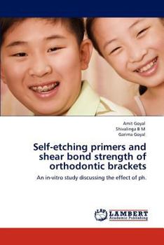 Paperback Self-etching primers and shear bond strength of orthodontic brackets Book