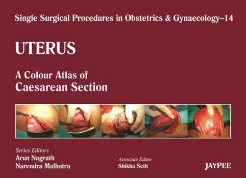 Hardcover Uterus: A Colour Atlas of Caesarean Section (Single Surgical Procedures in Obstetrics and Gynaecology) Book