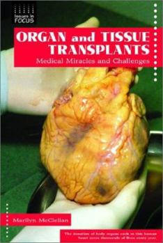 Library Binding Organ and Tissue Transplants: Medical Miracles and Challenges Book