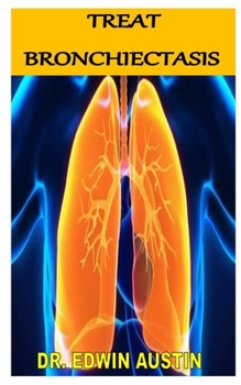 TREAT BRONCHIECTASIS: Discover the complete guides on everything you need to know about treatment of bronchiectasis