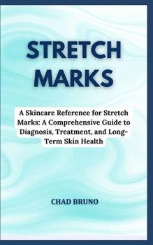 Paperback Stretch Marks: A Skincare Reference for Stretch Marks: A Comprehensive Guide to Diagnosis, Treatment, and Long-Term Skin Health Book