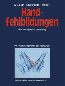 Paperback Handfehlbildungen: Atlas Ihrer Operativen Behandlung [German] Book