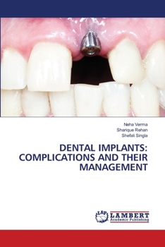 Paperback Dental Implants: Complications and Their Management Book