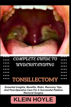 COMPLETE GUIDE TO UNDERSTANDING TONSILLECTOMY: Essential Insights, Benefits, Risks, Recovery Tips, And Post-Operative Care For A Successful Palatine Removal Surgery