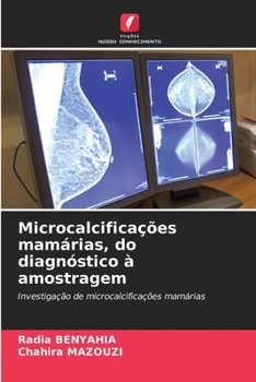 Microcalcificações mamárias, do diagnóstico à amostragem: Investigação de microcalcificações mamárias (Portuguese Edition)