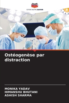 Ostéogenèse par distraction (French Edition)