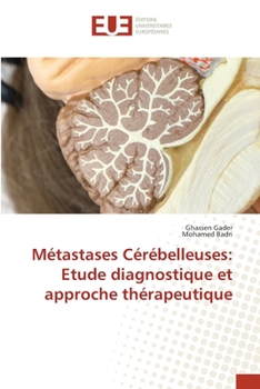 Paperback Métastases Cérébelleuses: Etude diagnostique et approche thérapeutique [French] Book