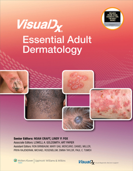 Hardcover Visualdx: Essential Adult Dermatology Book
