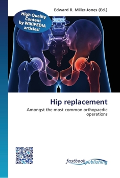 Paperback Hip replacement Book