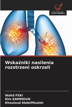 Paperback Wskaźniki nasilenia rozstrzeni oskrzeli [Polish] Book