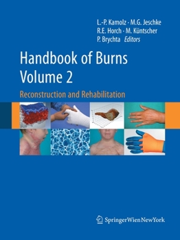 Paperback Handbook of Burns, Volume 2: Reconstruction and Rehabilitation Book