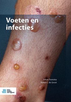 Hardcover Voeten En Infecties Book