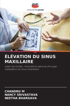 Paperback Élévation Du Sinus Maxillaire [French] Book