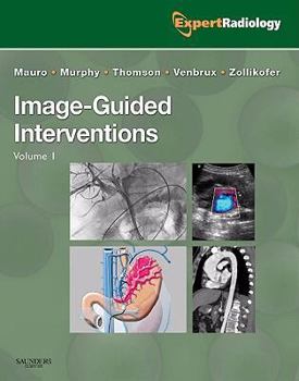 Hardcover Image-Guided Interventions: Expert Radiology Series Book