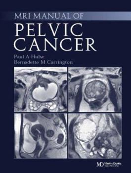 Hardcover MRI Manual of Pelvic Cancer Book