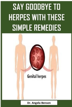 Paperback Say Goodbye to Herpes with These Simple Remedies: Easy To Read Guide On How To Get Rid Of Herpes Book