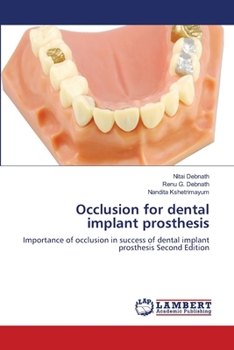 Paperback Occlusion for dental implant prosthesis Book