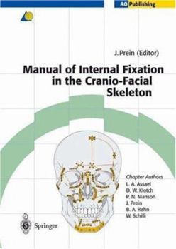 Hardcover Manual of Internal Fixation in the Cranio-Facial Skeleton: Techniques Recommended by the Ao/Asif Maxillofacial Group Book