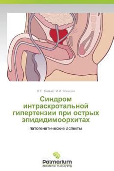 Paperback Sindrom Intraskrotal'noy Gipertenzii Pri Ostrykh Epididimoorkhitakh [Russian] Book