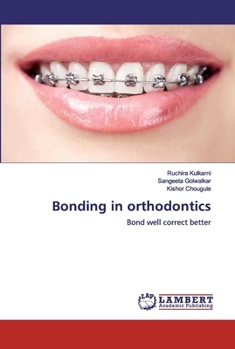 Paperback Bonding in orthodontics Book