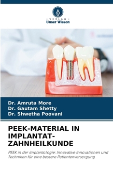 Paperback Peek-Material in Implantat-Zahnheilkunde [German] Book