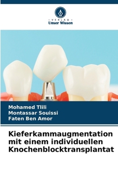 Kieferkammaugmentation mit einem individuellen Knochenblocktransplantat (German Edition)