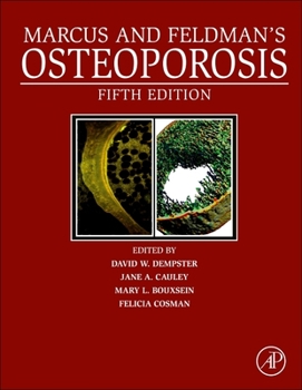 Misc. Marcus and Feldman's Osteoporosis Book