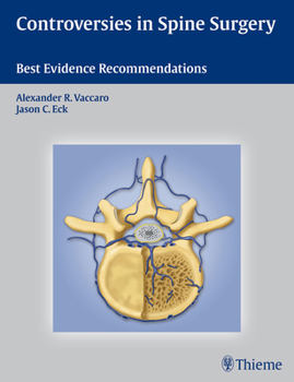 Hardcover Controversies in Spine Surgery: Best Evidence Recommendations Book