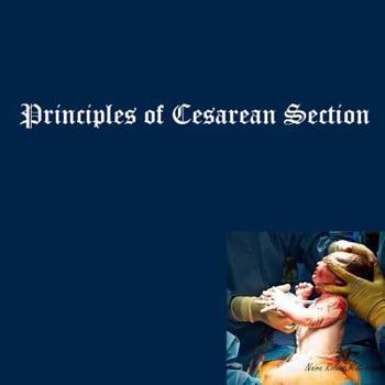 Paperback Principles of Cesarean Section Book