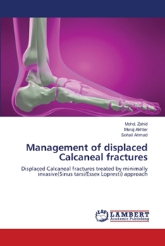 Paperback Management of displaced Calcaneal fractures Book