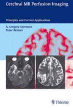 Hardcover Cerebral MR Perfusion Imaging: Principles and Current Applications Book