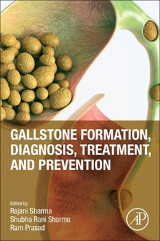 Paperback Gallstone Formation, Diagnosis, Treatment and Prevention Book