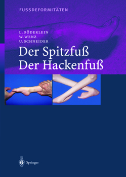 Paperback Fussdeformitäten: Der Spitzfuss/Der Hackenfuss [German] Book