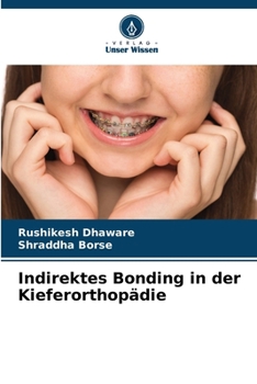 Indirektes Bonding in der Kieferorthopädie (German Edition)