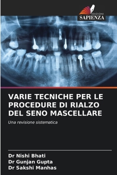 Paperback Varie Tecniche Per Le Procedure Di Rialzo del Seno Mascellare [Italian] Book