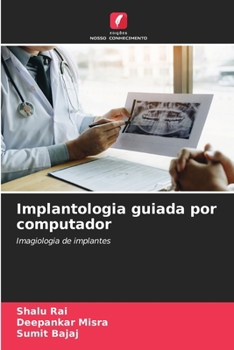 Paperback Implantologia guiada por computador [Portuguese] Book