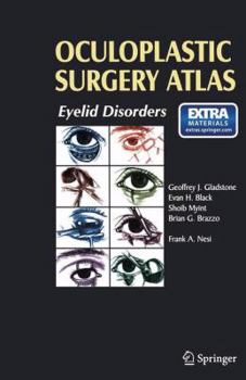 Paperback Oculoplastic Surgery Atlas: Eyelid Disorders Book