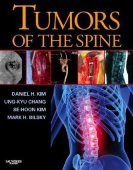 Hardcover Tumors of the Spine [With CDROM] Book