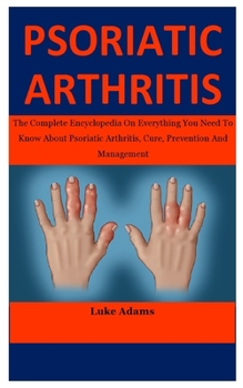 Paperback Psoriatic Arthritis: The Complete Encyclopedia On Everything You Need To Know About Psoriatic Arthritis, Cure, Prevention And Management Book
