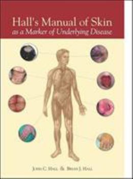 Hardcover Hall's Manual of Skin as a Marker of Underlying Disease Book
