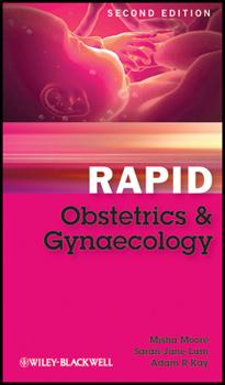 Paperback Rapid Obstetrics and Gynaecology Book
