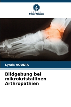 Paperback Bildgebung bei mikrokristallinen Arthropathien [German] Book