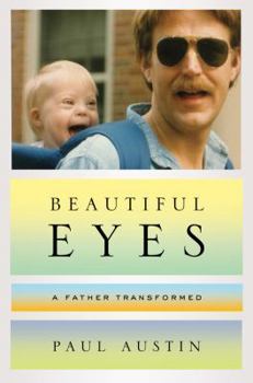 Hardcover Beautiful Eyes: A Father Transformed Book
