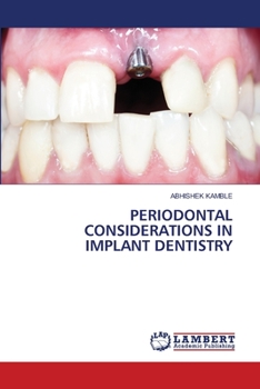 Paperback Periodontal Considerations in Implant Dentistry Book
