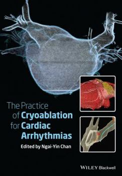 Hardcover The Practice of Catheter Cryoablation for Cardiac Arrhythmias Book